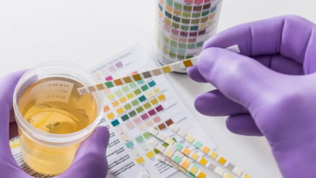 types of drug screening
